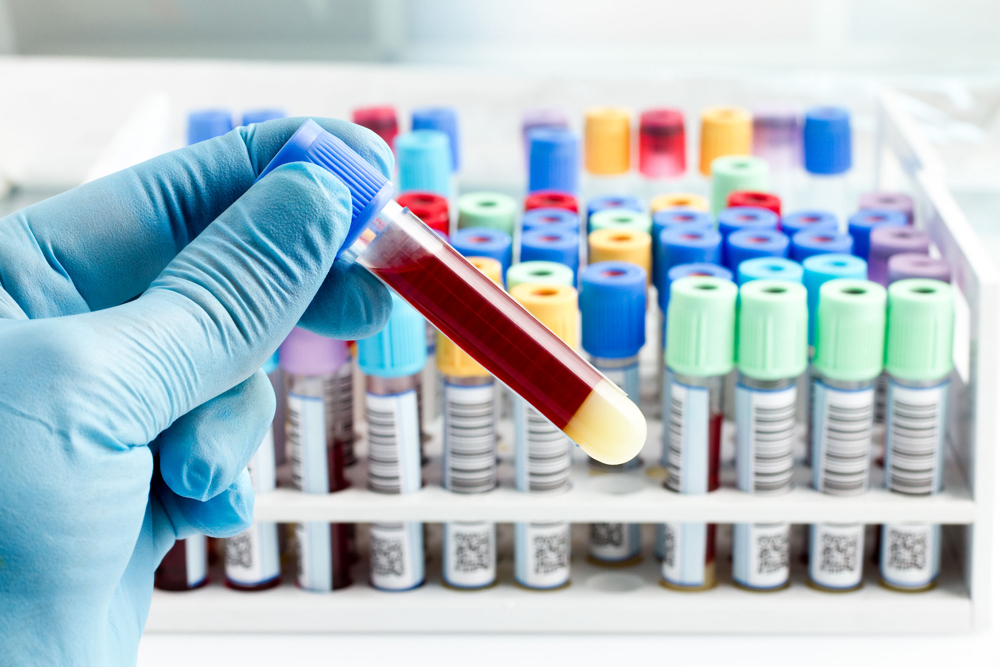 Mandated Employee DOT Drug Testing Rules | SAP Referral Services