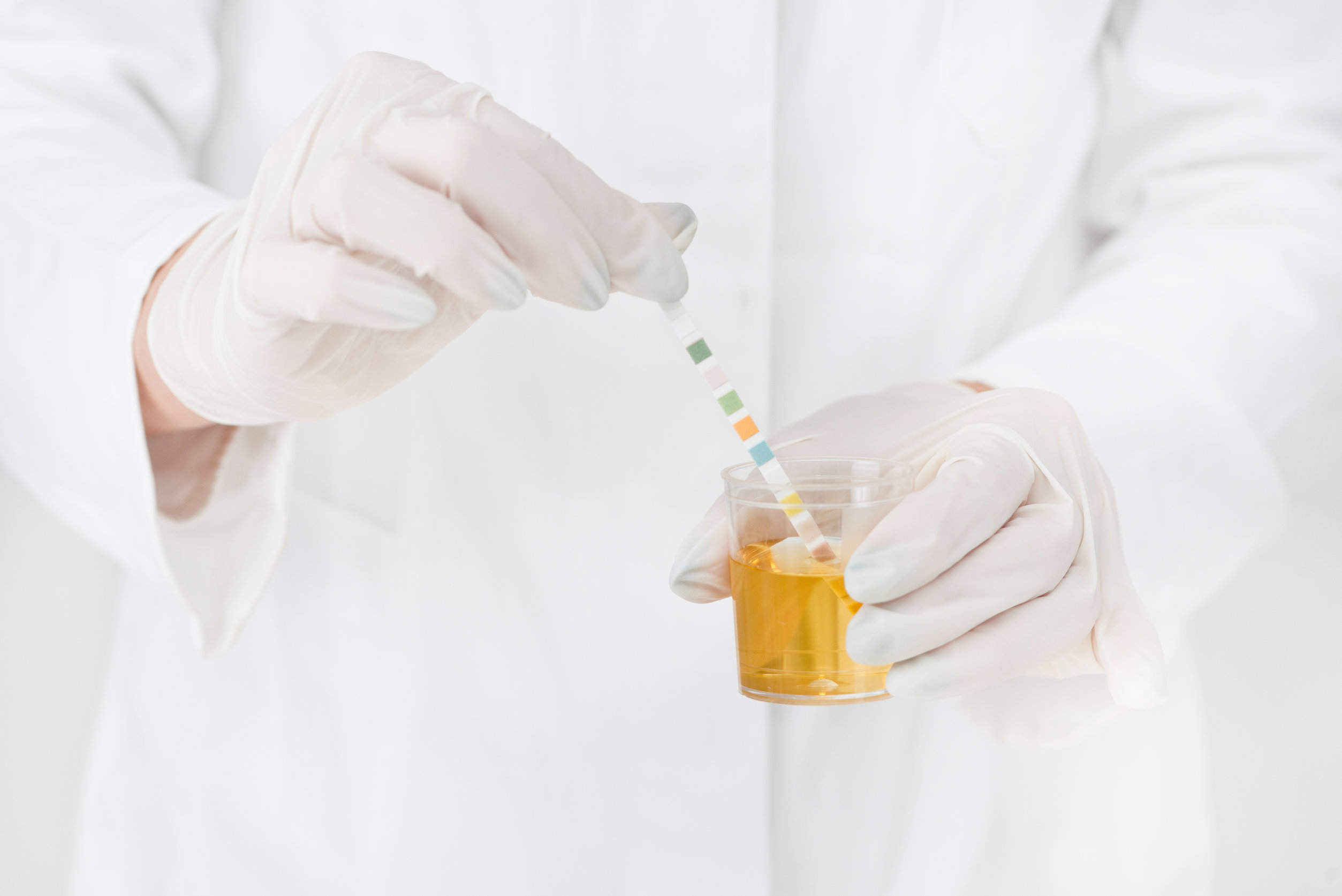 What Happens if I Fail Post-Accident Drug Testing? | SAP Referral Services