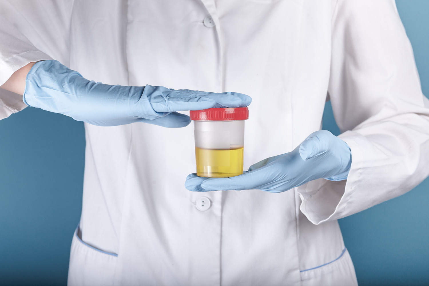 What Happens if I Refuse a DOT Drug Test? | SAP Referral Services