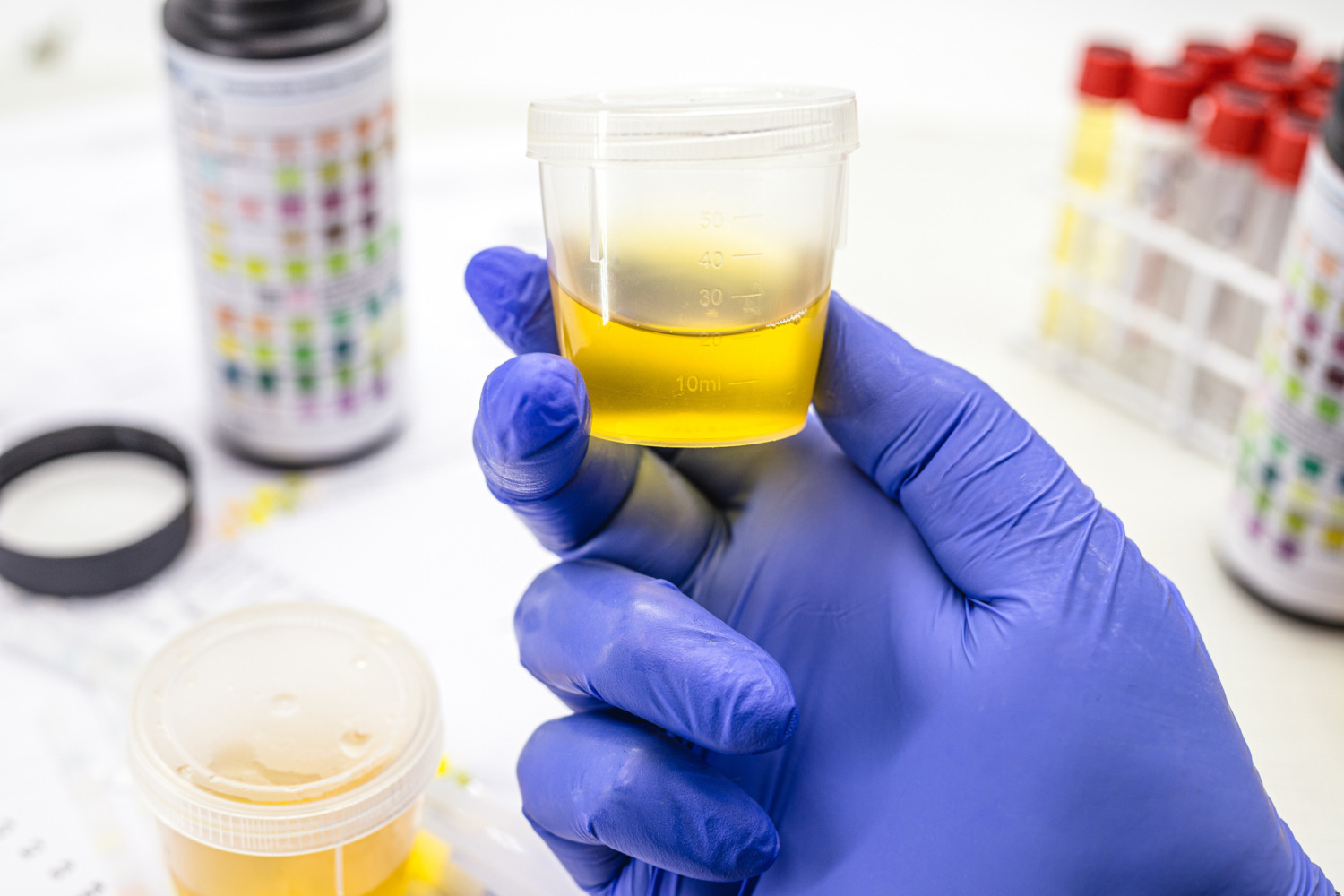 5-Panel Drug Test for Federally Regulated Employees | SAP Referral Services